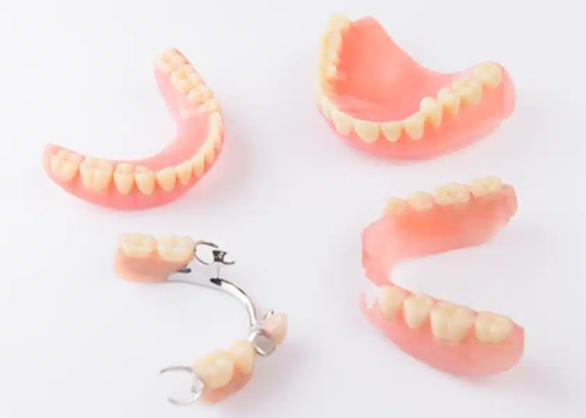 Removable Denture